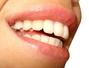 Sfaturi Pentru dinti - Alimente bune si alimente rele pentru dinti