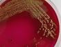 Sfaturi Bacterii - Testarea ADN-ului din materiile fecale poate depista din timp cancerul de colon